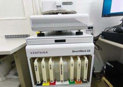 Nuevo equipo automatizado de roche para el Servicio de Anatomía Patológica del HSB